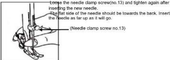TRISTAR SM6001 - Inserting the needle - 1