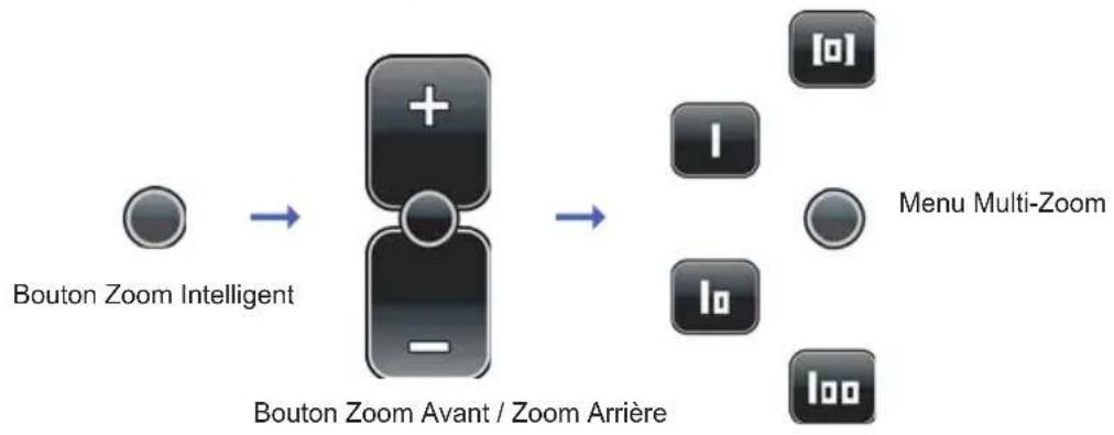 GRUNDIG GPS M1 - Le bouton zoom intelligent et le menu multi-zoom - 1