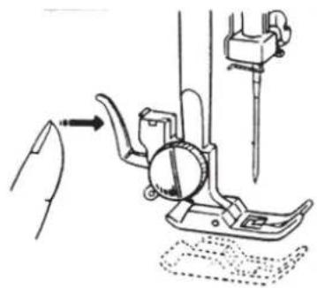 MEDION MD 17187 - Entfernen - 1