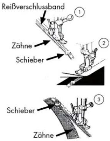 MEDION MD 17187 - Reißverschlüsse einnähen - 1
