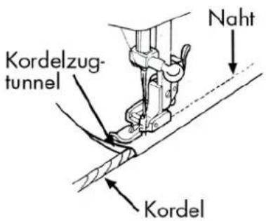 MEDION MD 17187 - Kordeln einnähen - 1