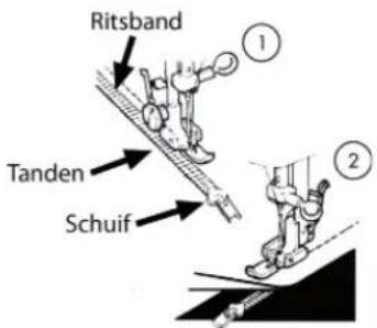 MEDION MD 17187 - Ritssluitingen innaaien - 1