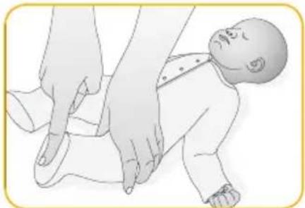Joblotron BM02 Nanny - Произведите 3–5 легких ударов по спинке ребенка - 1