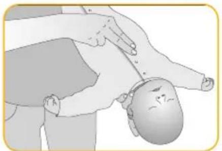 Joblotron BM02 Nanny - Give 3-5 chest thrusts - 1