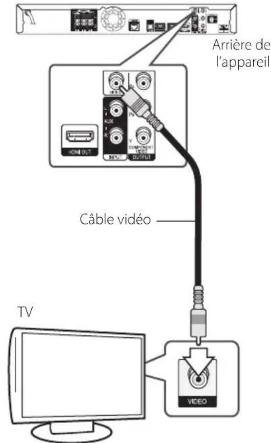 PIONEER XVBD515FSW - Connexion video - 1