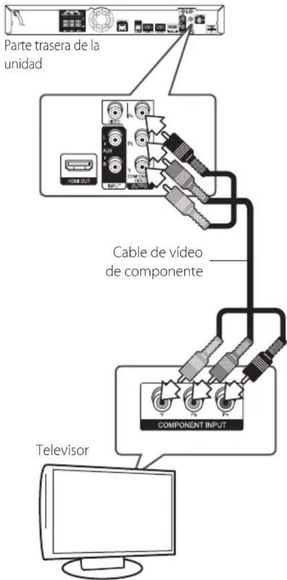 PIONEER XVBD515FSW - Conexión de video componente - 1