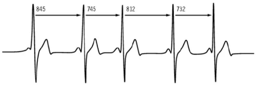 POLAR CS 600X - Variabilité de la fréquence cardiaque - 1