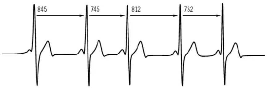 POLAR CS 400 - Variabilité de la fréquence cardiaque - 1