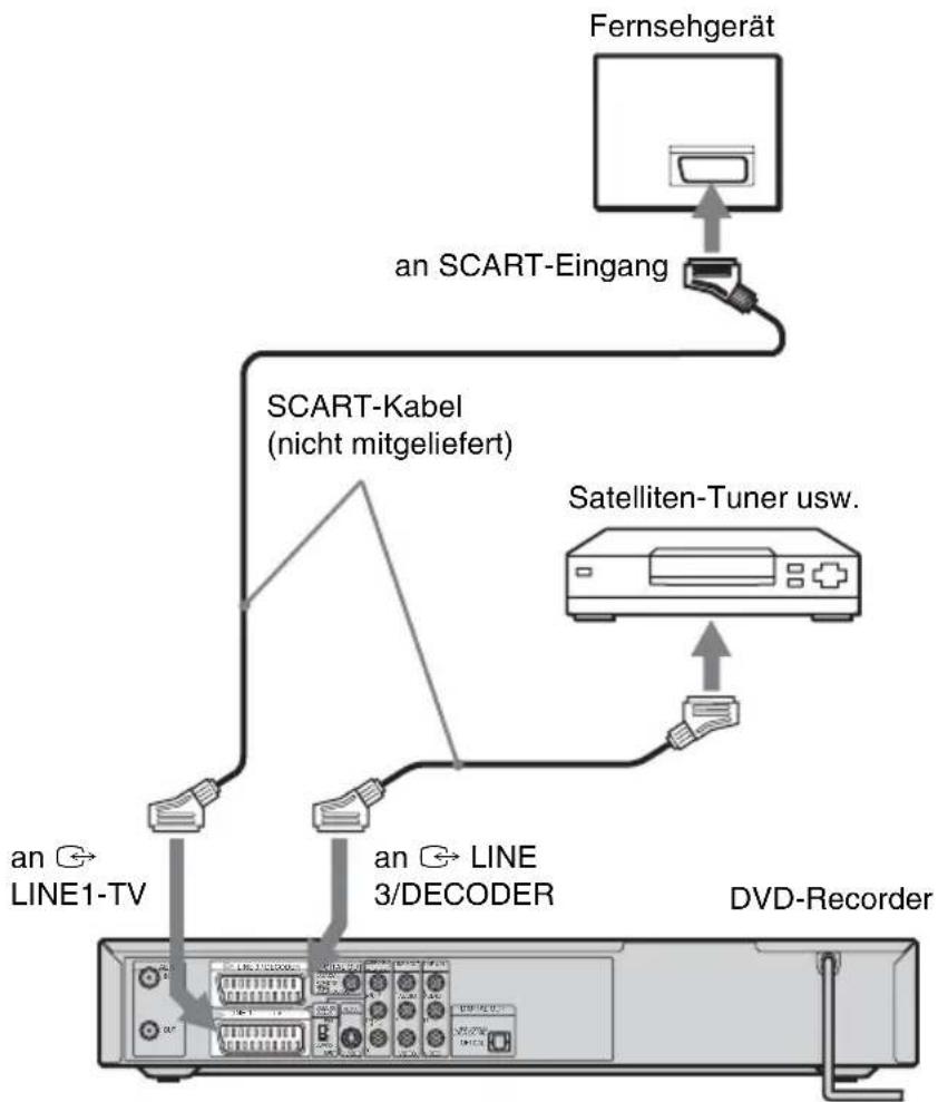 SONY DARRD100 - Anschließen an einen Satelliten- oder Digital-Tuner - 1
