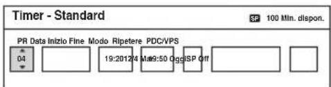 SONY DARRD100 - Impostazione manuale del timer (Standard) - 3