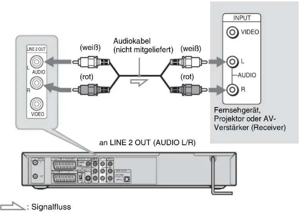 SONY DARRD100 - Anschließen der Audiokabel - 1