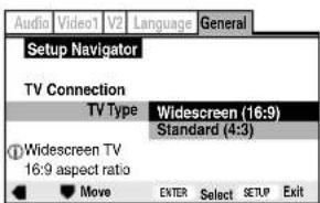 PIONEER XVDV88 - Sélectionnez le type de téléviseur dont vous disposez. - 1