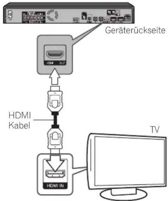 PIONEER XVBD621FSW - HDMI-Anschluss - 1