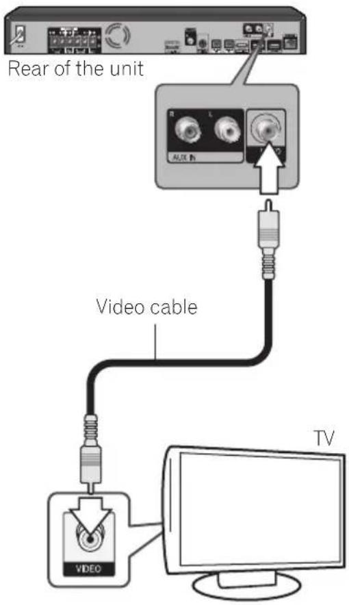 PIONEER XVBD621FSW - Video connection - 1