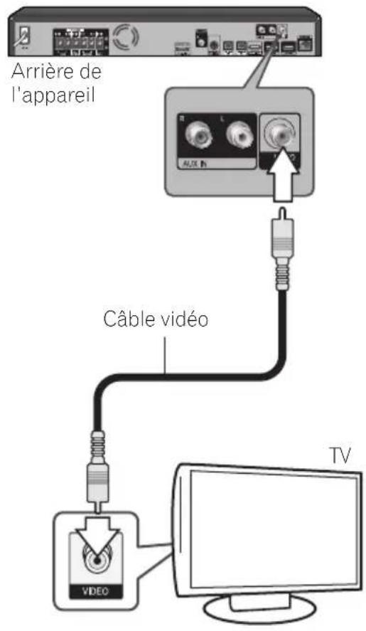 PIONEER XVBD621FSW - Connexion vidéo - 1