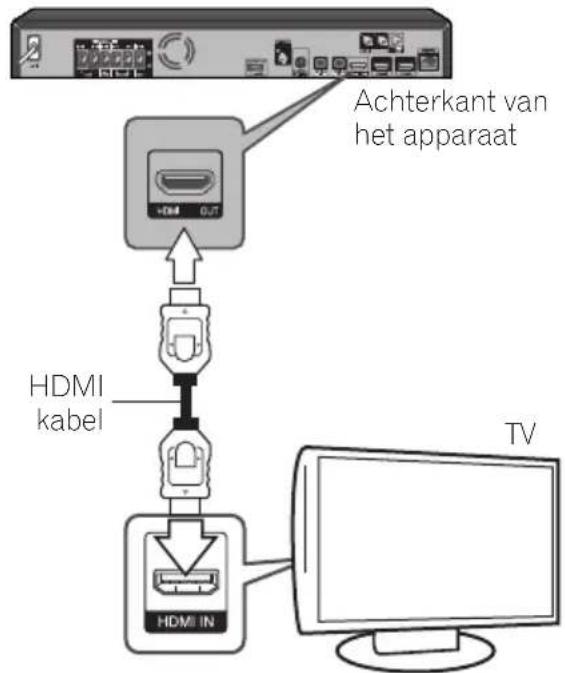 PIONEER XVBD621FSW - HDMI-aansluiting - 1