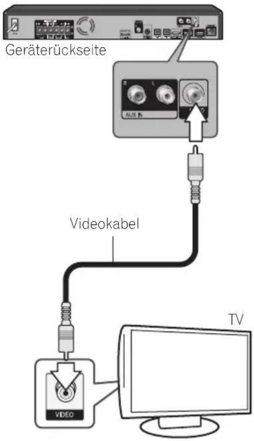 PIONEER XVBD621FSW - Video-Anschluss - 1