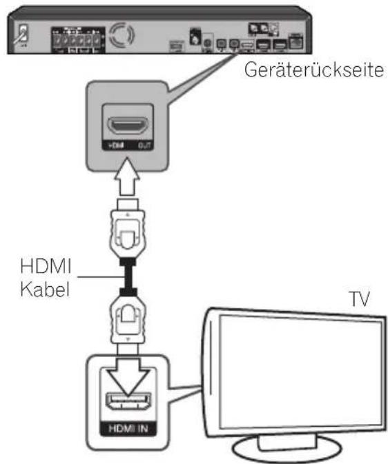PIONEER XVBD121W - HDMI-Anschluss - 1
