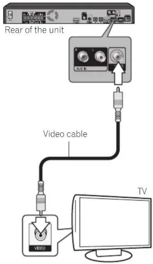 PIONEER XVBD121W - Video connection - 1