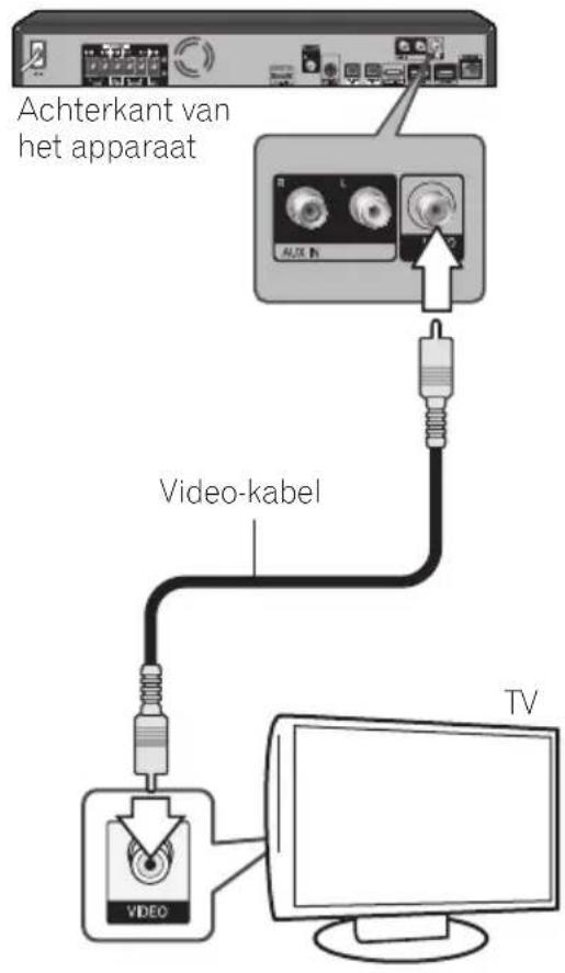 PIONEER XVBD121W - Video-aansluiting - 1