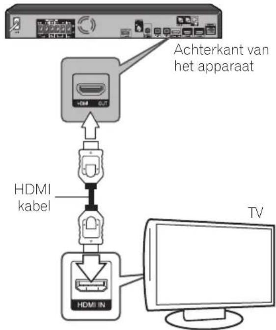 PIONEER XVBD521FSW - HDMI-aansluiting - 1