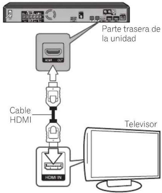 PIONEER BCS424 - Conexión HDMI - 1