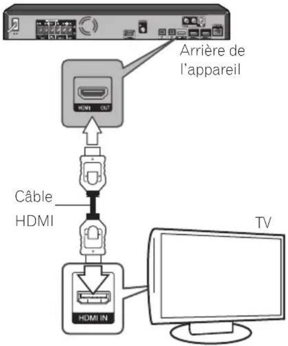 PIONEER BCS424 - Connexion HDMI - 1