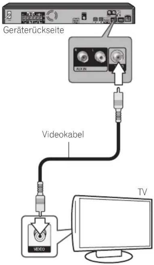 PIONEER BCS424 - Video-Anschluss - 1