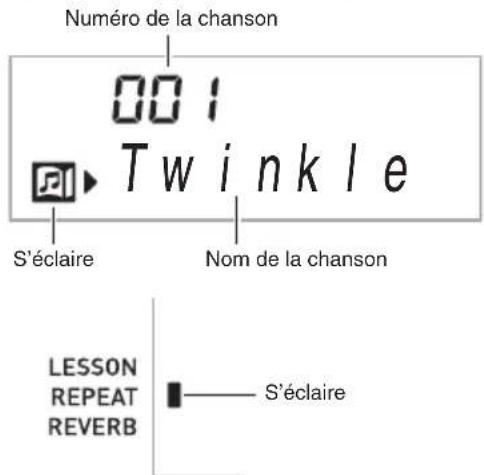 CASIO LK175 - Appuyez sur ① (SONG BANK). - 1