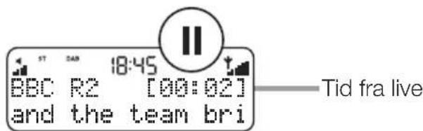PURE One Classic Series 2 - Pause og tilbagespoling af live-radio - 1