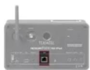 Noxon IRadio for iPod - Câble ou radio ? - 1