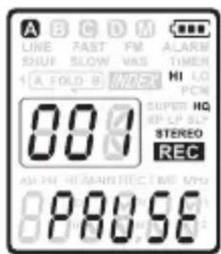 dnt HSQ2010 - Mit integriertem Mikrofon aufnehmen - 2