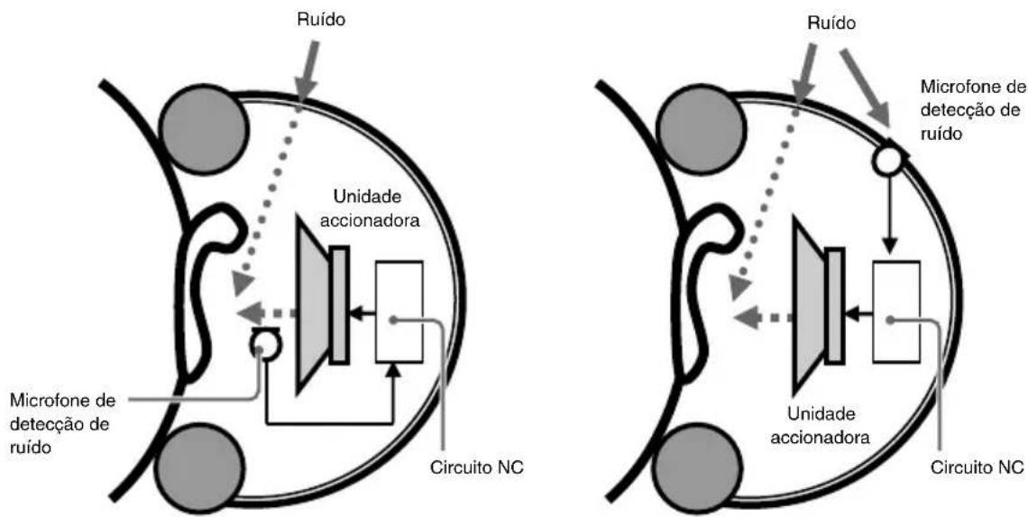 SONY MDRNC500D - Tipo feedforward - 1