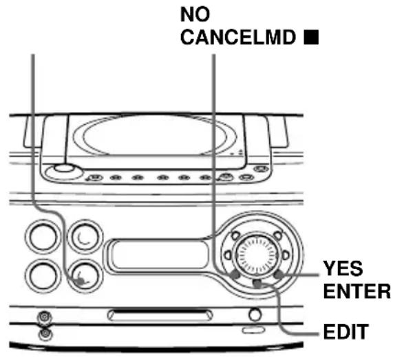 SONY ZSM30 - Löschen von Aufnahmen (Erase-Funktion) - 1
