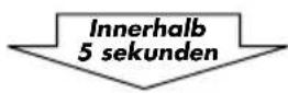 JVC KSLX200R - So geben Sie Titel wiederholt wieder (wiederholte Wiedergabe) - 2