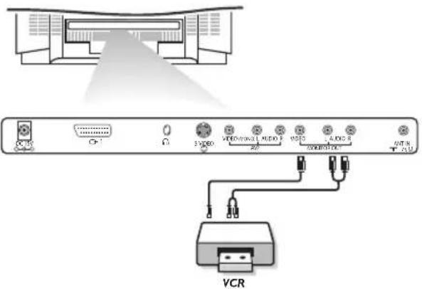 VCR