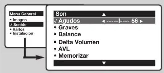 PHILIPS 28DW6559 - Ajustes del sonido - 1