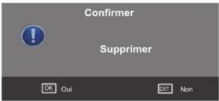 SEG Washington - Supprimer le transpondeur - 1
