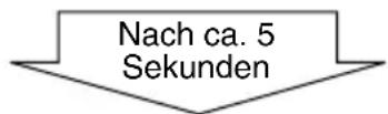 JVC KDSH9102 - Wenn während des Betriebs Rauschen auftritt, das die Wiedergabe beeinträchtigt - 4