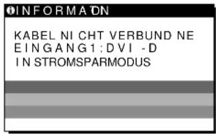 SONY SDMX72 - Wenn KABEL NICHT VERBUNDEN auf dem Bildschirm erscheint - 1