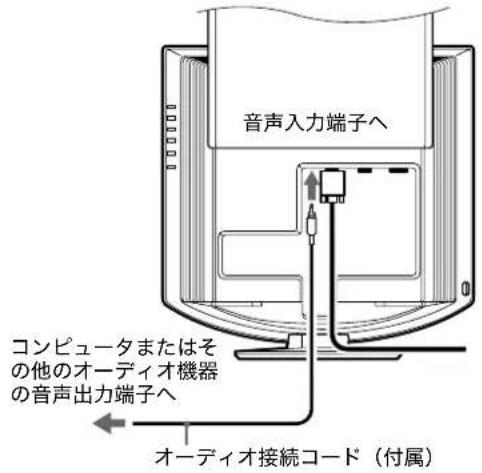 SONY SDMHX75 - 準備 2：オーディオ接続コードをつなぐ - 1