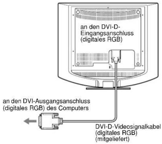 SONY SDMHS94P - Anschließen eines Computers mit einem DVI-Ausgangsanschluss (digitales RGB) - 1