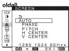 SONY SDMHS75D - SCREEN (11. - 1