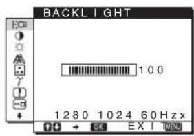 SONY SDMHS75D - BACKLIGHT@ (pagina 11) - 1
