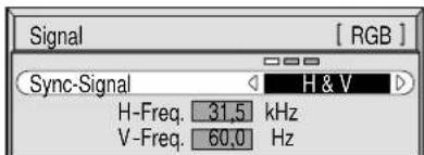 YAMAHA PDM1 - Sync-Signal - 4