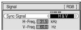 YAMAHA PDM1 - Menü-Anzeige auf dem Bildschirm mit der Fernbedienung - 6