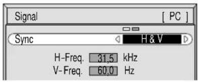 YAMAHA PDM1 - SYNC - 1