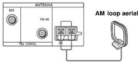SONY STD777ES - What will I need? - 3