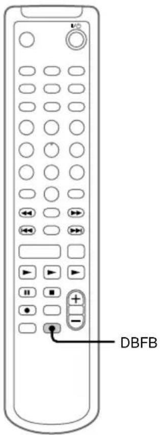 SONY DHCMD595 - Réglage du son - 1
