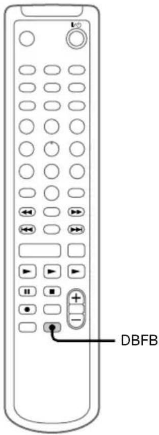 SONY DHCMD595 - Verstärken der Bässe - 1